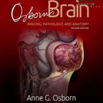 دانلود کتاب مغز آزبورن : تصویربرداری، پاتولوژی و آناتومی PDF